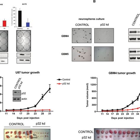 Attenuation Of P32 Expression Reduces Glioma Cell Proliferation And