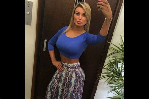 Andressa Urach La Ex Miss Bum Bum Que Sufre Por Un Mal Procedimiento