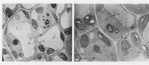 Figure From La Cellule V G Tale Observ E Au Microscope Lectronique