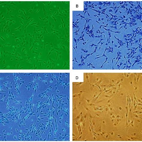 Morphological Representation Of Chondrocytes At Passage One A Download Scientific Diagram