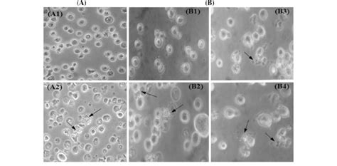 Cell Morphology Microscopic Pictures Showing The Cytotoxicity Of