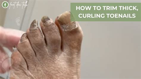 How To Trim Thick Curling Toenails Youtube