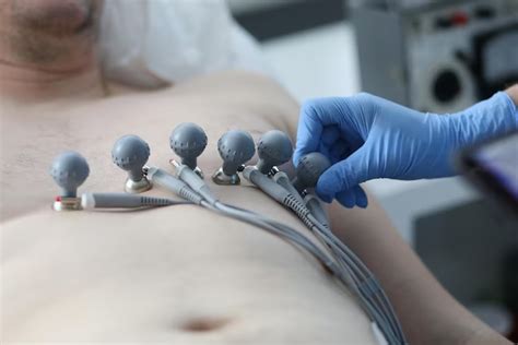 Electrocardiograma Qué es y cómo se mide Genea