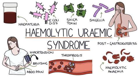 Hemolytic Uremic Syndrome MEDizzy