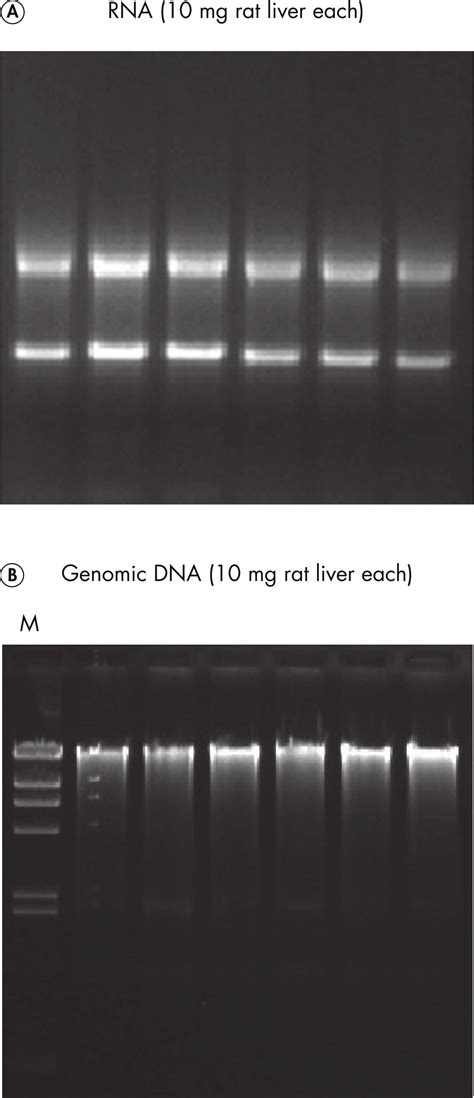 Allprep Dna Rna Kits Dna Rna Purification Kits Qiagen