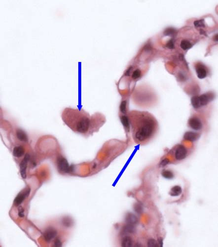 Histology Respiratory Flashcards Quizlet