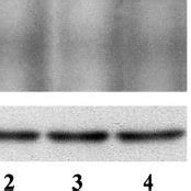 Rt Pcr Analysis Of Monocyte Chemotactic Protein Mcp Macrophage