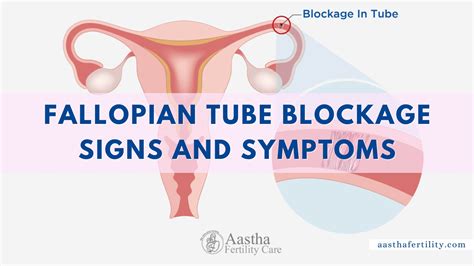 Blocked Fallopian Tubes Symptoms Causes Treatments Off