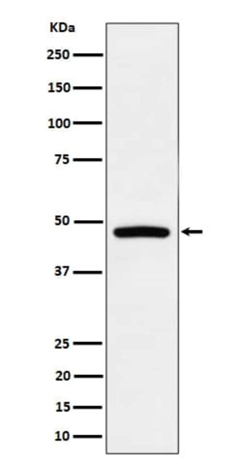 PREB Antibody SR1780 Novus Biologicals 50 μg Unconjugated