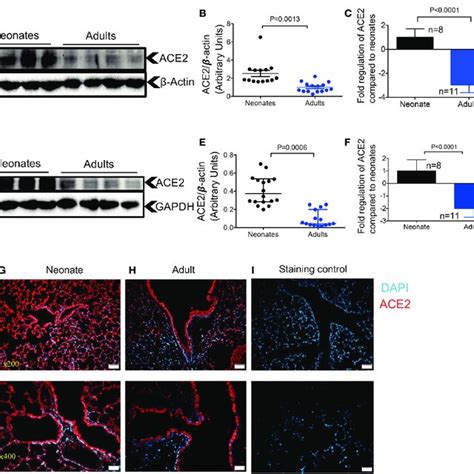 Differential Expression Of Ace And Tmprss In The Lung And Heart