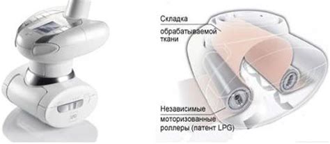 Массаж LPG. Отзывы, фото до и после: аппаратный, ваккумный массаж лица ...