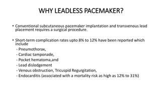 Leadless pacemaker | PPT