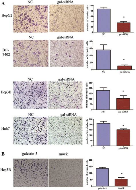 Galectin 3 Overexpression Promoted HCC Cell Invasion Whereas Knockdown