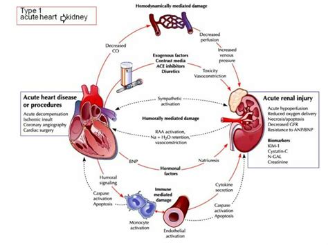 Heart Failure Diagram