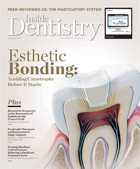 January 2017 | Inside Dentistry