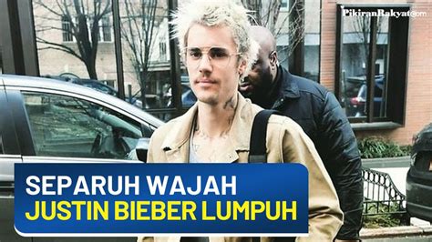 Separuh Wajah Justin Bieber Lumpuh Total Seperti Yang Kalian Lihat