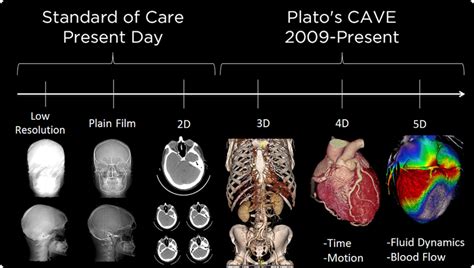 Why are doctors still using 2D imaging (CT an MRI scans) when 3D is ...