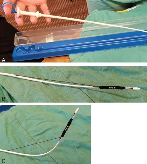 Stent Placement | Thoracic Key