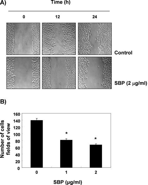 Inhibition Of Cell Motility And Invasion By Svb Treatment In A