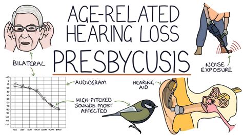 Understanding Presbycusis: Age-Related Hearing Loss - YouTube