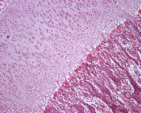 Endochondral Ossification Histology