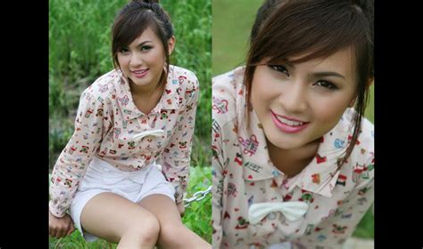 Cận cảnh hot girl Kelly sau lần dao kéo