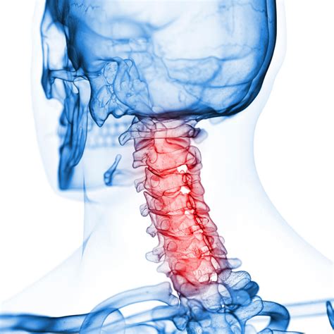 Anatomy The Cervical Spine What Chiropractic Patients Need To