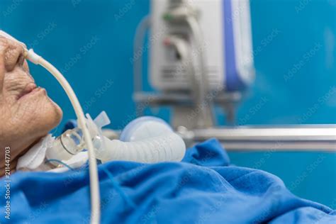 Patient Do Tracheostomy And Ventilator In Hospital Stock Photo Adobe