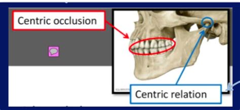 Angles Classification Occlusion Flashcards Quizlet