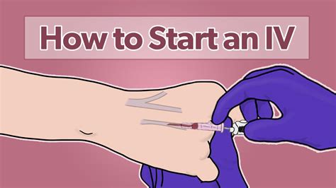 How To Start An Iv Ultimate Beginners Guide Health And Willness