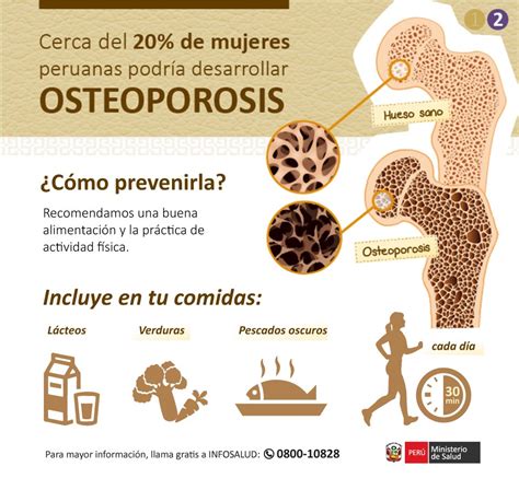 Mujer Y Salud Conoce Cómo Puedes Prevenir La Osteoporosis Comparte Esta Información Con Tu Mamá