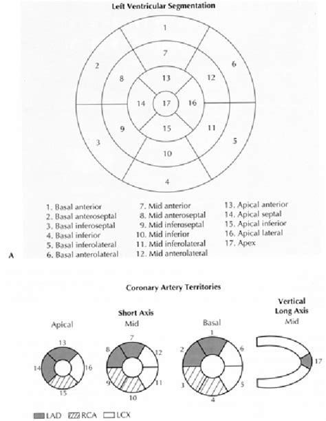 Figure 1 From THE VALUE OF MYOCARDIAL PERFUSION IMAGING WITH TC 99M