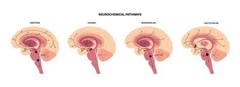 Treadmill Exercise And Your Brain A Relationship With Neurotransmitters