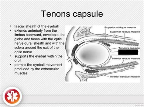 Conjunctiva