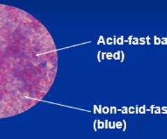 Lab Exercise 9 Differential Stains Gram Stain Acid Fast Stain And