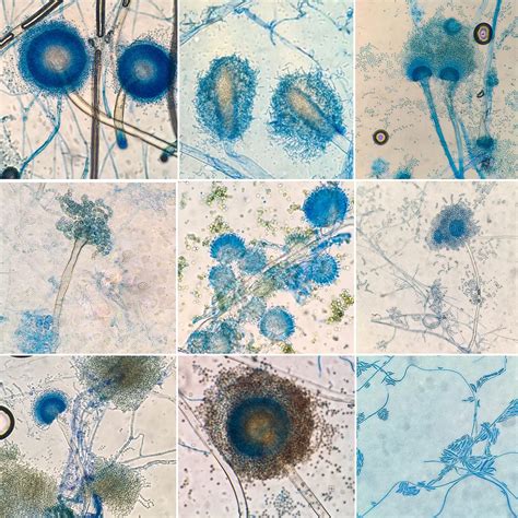 Aspergillus Flavus Under Microscope