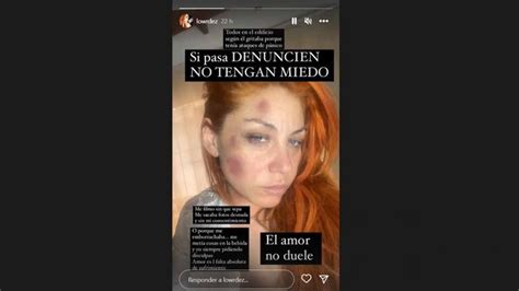 Lourdes Fern Ndez Ex Bandana Denunci A Su Exnovio Por Violencia De