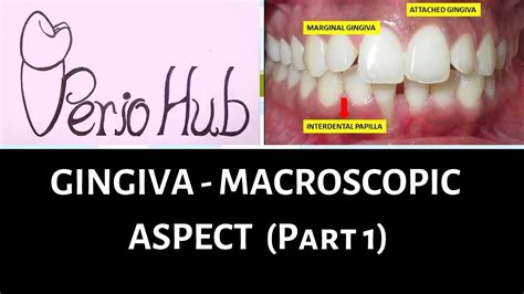 GINGIVA - Marginal/ Free gingiva - YouTube