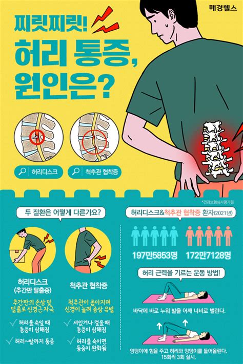 허리 통증 있어도 허리디스크 아닐 수 있어허리 통증 원인은