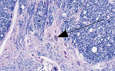 Central Nervous System And Quiz 2 Histology