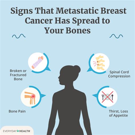 What Happens When Metastatic Breast Cancer Spreads To Your Bones