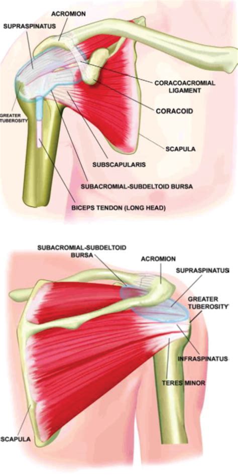 Figure 2 From The Role Of Apoptosis In Rotator Cuff Tendinopathy