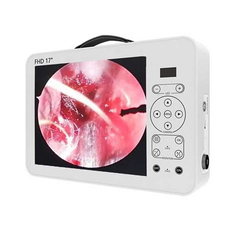 Portable Minimally Invasive Surgery Medical Hd Endoscope Camera