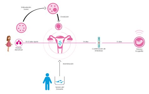 Inseminaci N Artificial Con Semen Del Donante Dhfertilidad