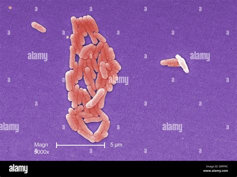 SEM of Salmonella typhimurium bacteria Stock Photo - Alamy