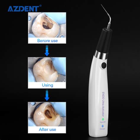 High Performance Azdent Cordless Endodontic Dental Ultrasonic Activator