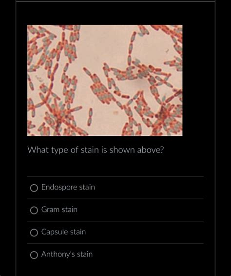 Solved What Type Of Stain Is Shown Above Endospore Staingram Chegg