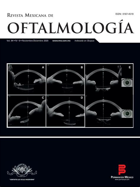 PDF REVISTA MEXICANA DE OFTALMOLOGÍAREVISTA MEXICANA DE OFTALMOLOGÍA