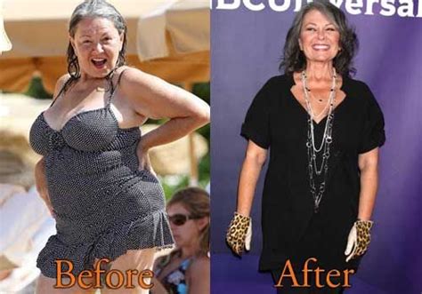 Roseanne Barr Weight Loss