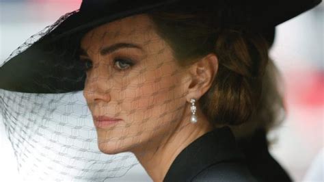 “kate Middleton Era In Coma Hanno Dovuto Intubarla” Ma Kensington Palace Smentisce